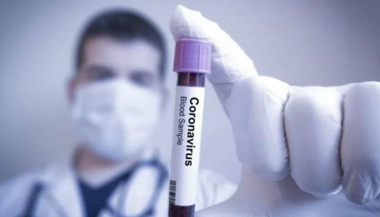 84 Wartawan MNC Group Dinyatakan Positif Terinfeksi Covid-19