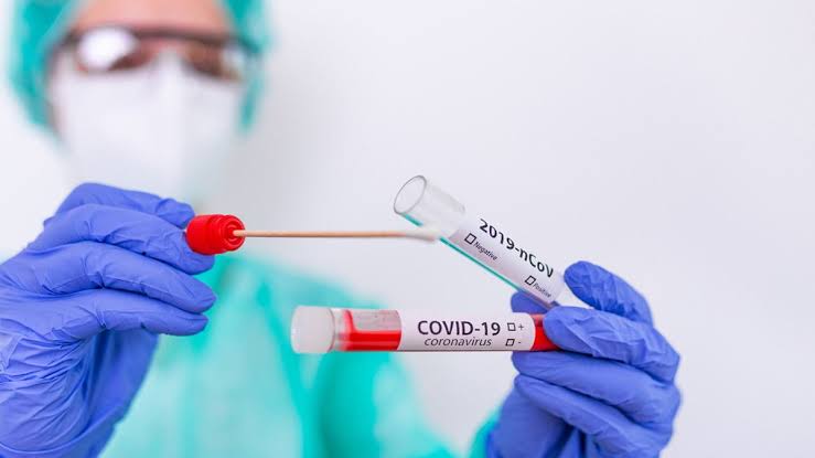 Tarif PCR di NTB Sesuai Permenkes